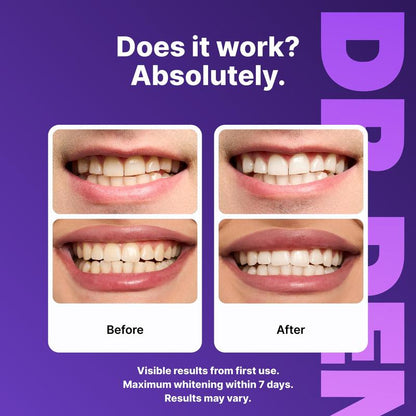 DRDENT Purple Teeth Whitening Strips - 7/21 Whitening Sessions - Safe for Enamel - Non Sensitive Teeth Whitening - Peroxide-Free